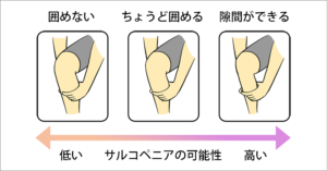 サルコペニア２