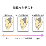 サルコペニア