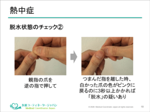 親指の爪を押す熱中症のサイン(脱水状態)チェック